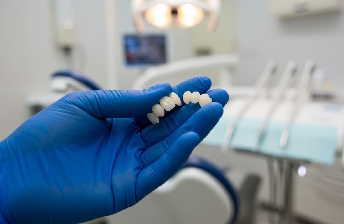 Best dental veneers clinic Nigeria