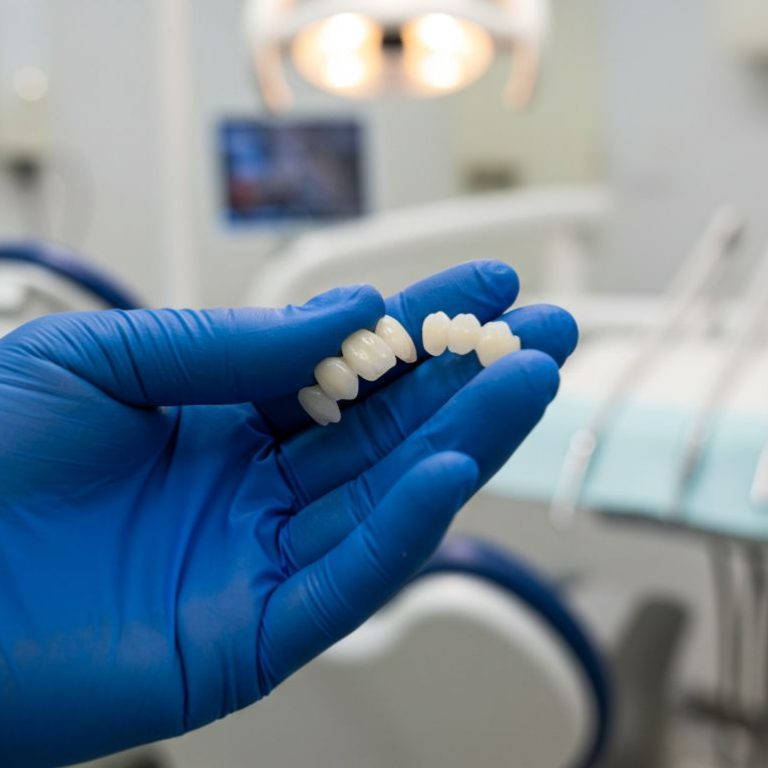 Best dental veneers clinic Nigeria