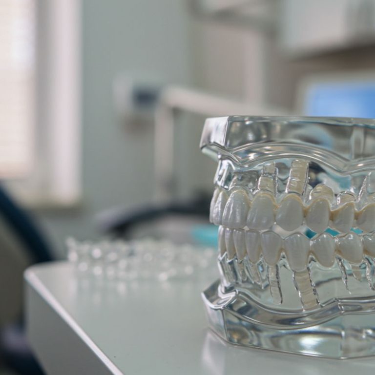 Invisalign dentist near me